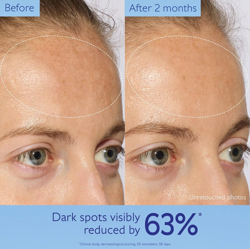 Before and after comparison of dark spots on a person's face with text indicating 63% reduction.