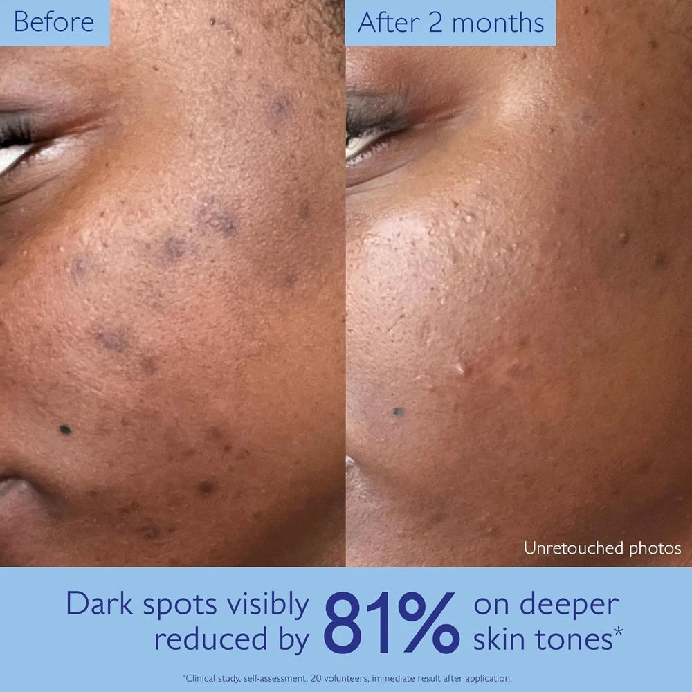 Before and after comparison of dark spots on skin with text indicating reduction.