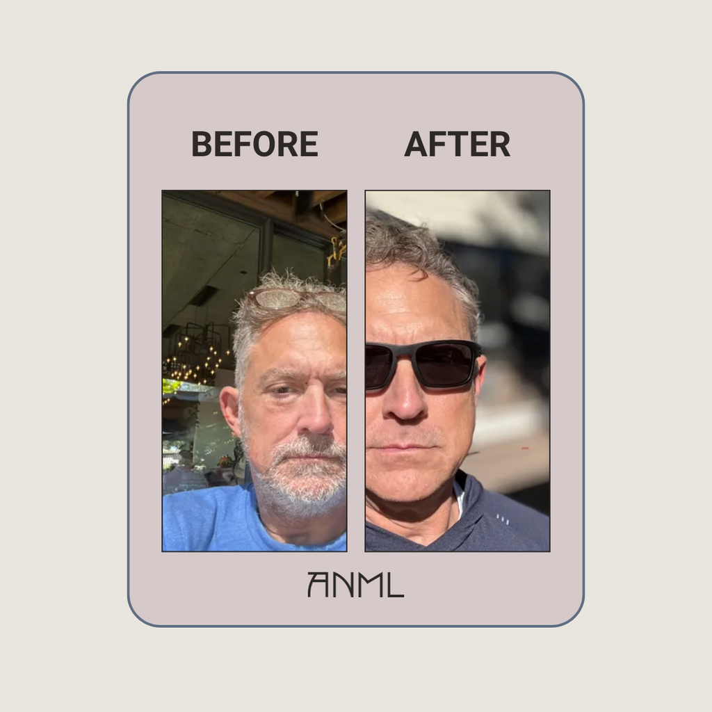 Before and after comparison of a man with ANML logo