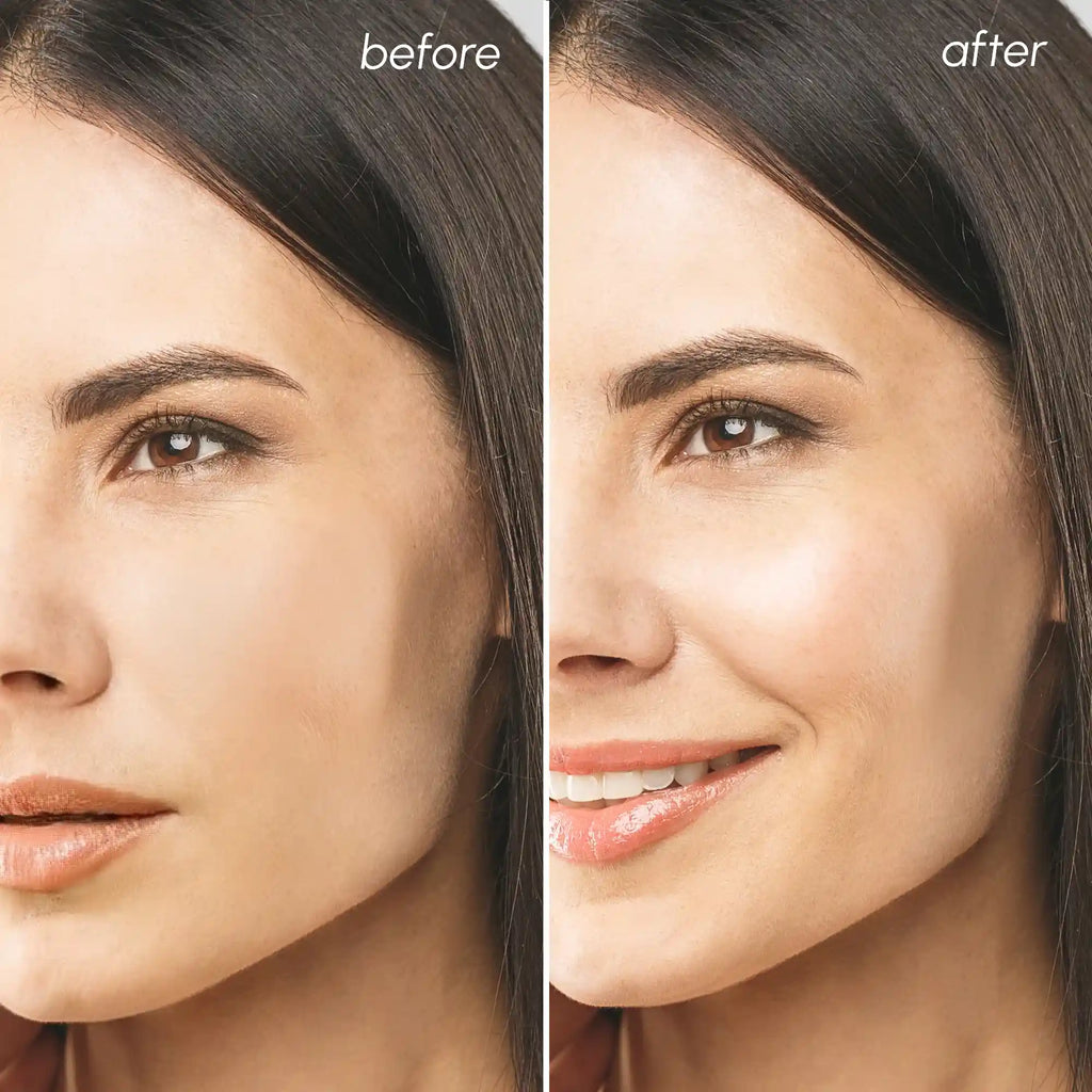 Before and after comparison of a woman's face with visible skin improvement.