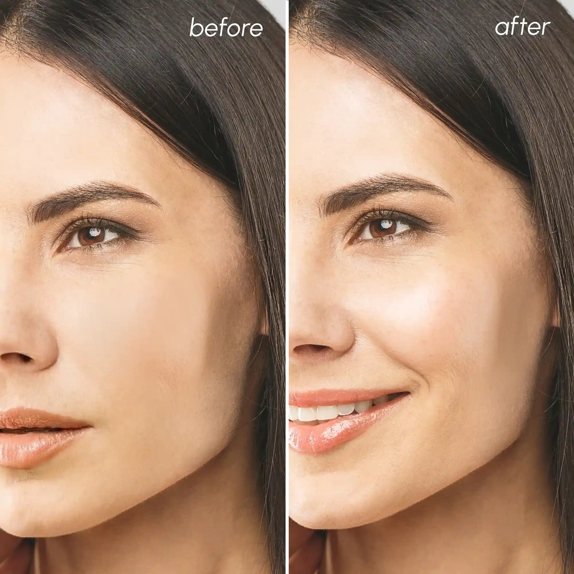 Before and after comparison of a woman's face with visible skin improvement.