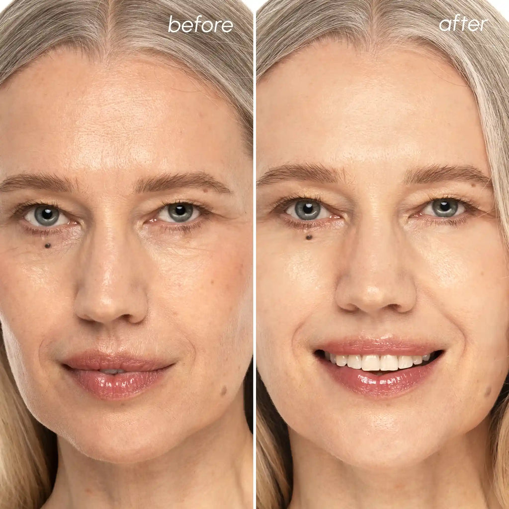 Before and after comparison of a woman's face with visible skin improvement.