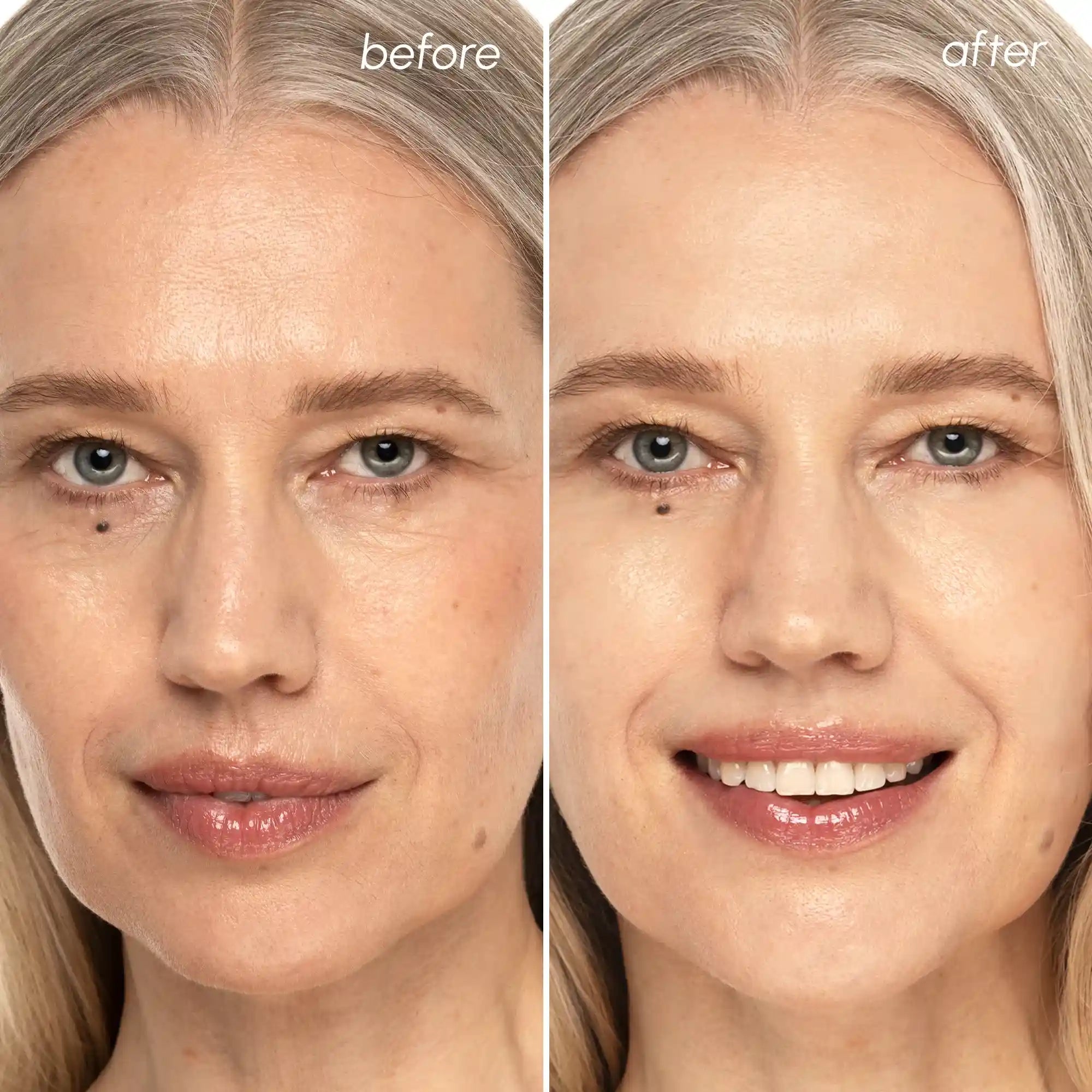Before and after comparison of a woman's face with visible skin improvement.