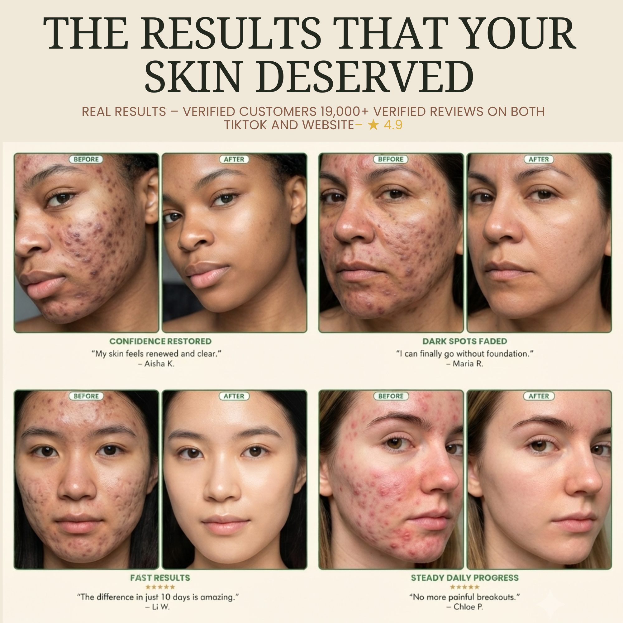 A promotional graphic with the headline 'THE RESULTS THAT YOUR SKIN DESERVED' above eight before-and-after skin photos showing facial acne, dark spots, and clearer skin. Small review quotes and names appear beneath some panels.