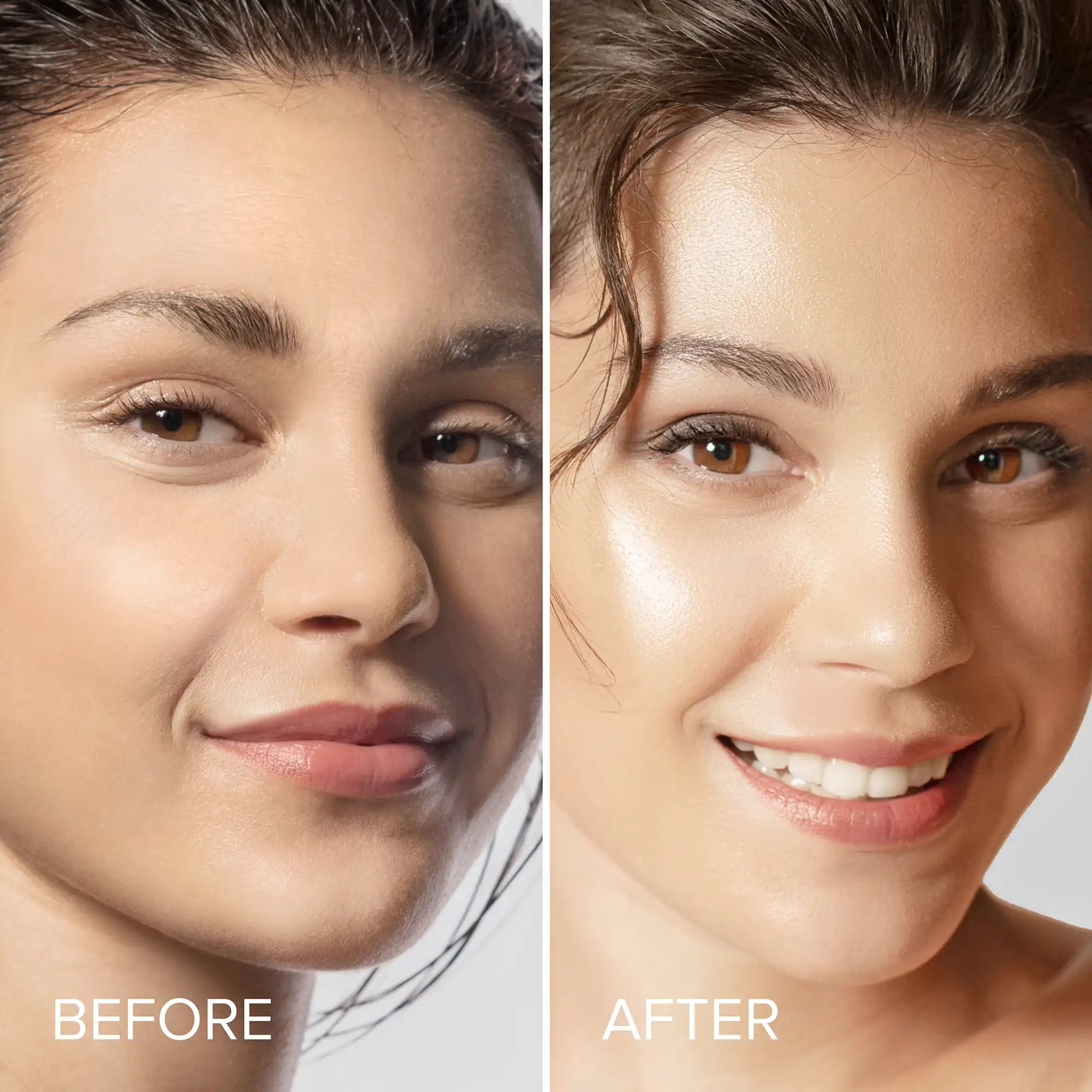 Before and after comparison of a woman's face with visible skin improvement.